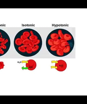 Understanding IV Fluids thumbnail