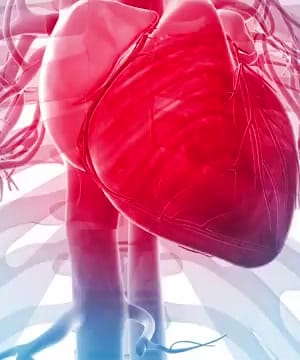 Understanding Artery Plaque thumbnail